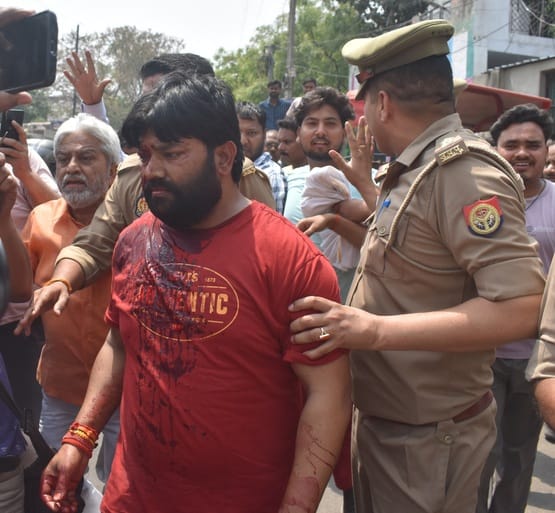 BJP councillor fired bullets on employees when garbage van did not arrive
