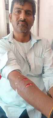 Monkeys attacked a youth in Chandralok Colony
