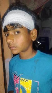 Tension: Stone pelting during the program, one child injured, police deployed in the village