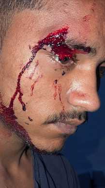 A youth standing outside his house was attacked with a knife