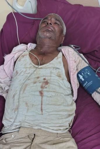 Thieves cut off security guard's tongue