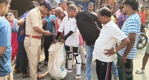 Muzaffarpur Bihar news young man severed leg found in middle of road when he was hit by train