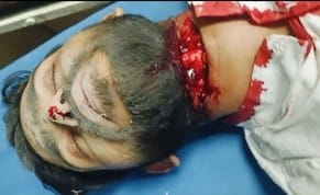 A young man's neck was cut with a Chinese string on Haridwar road