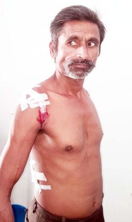 A tiger attacked a farmer working in the field and hit him with its paw