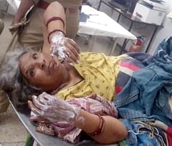 Grandmother and daughter-in-law burnt in fire caused by gas leak