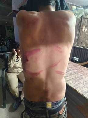 The couple was beaten with sticks and rods due to enmity