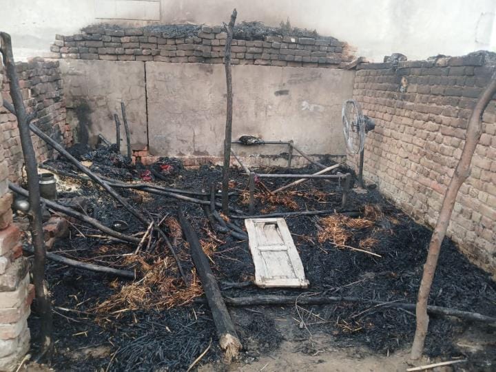 A two year old child got burnt in a hut fire. He died in AIIMS