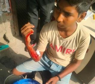 Monkey bites child, townspeople troubled by uproar
