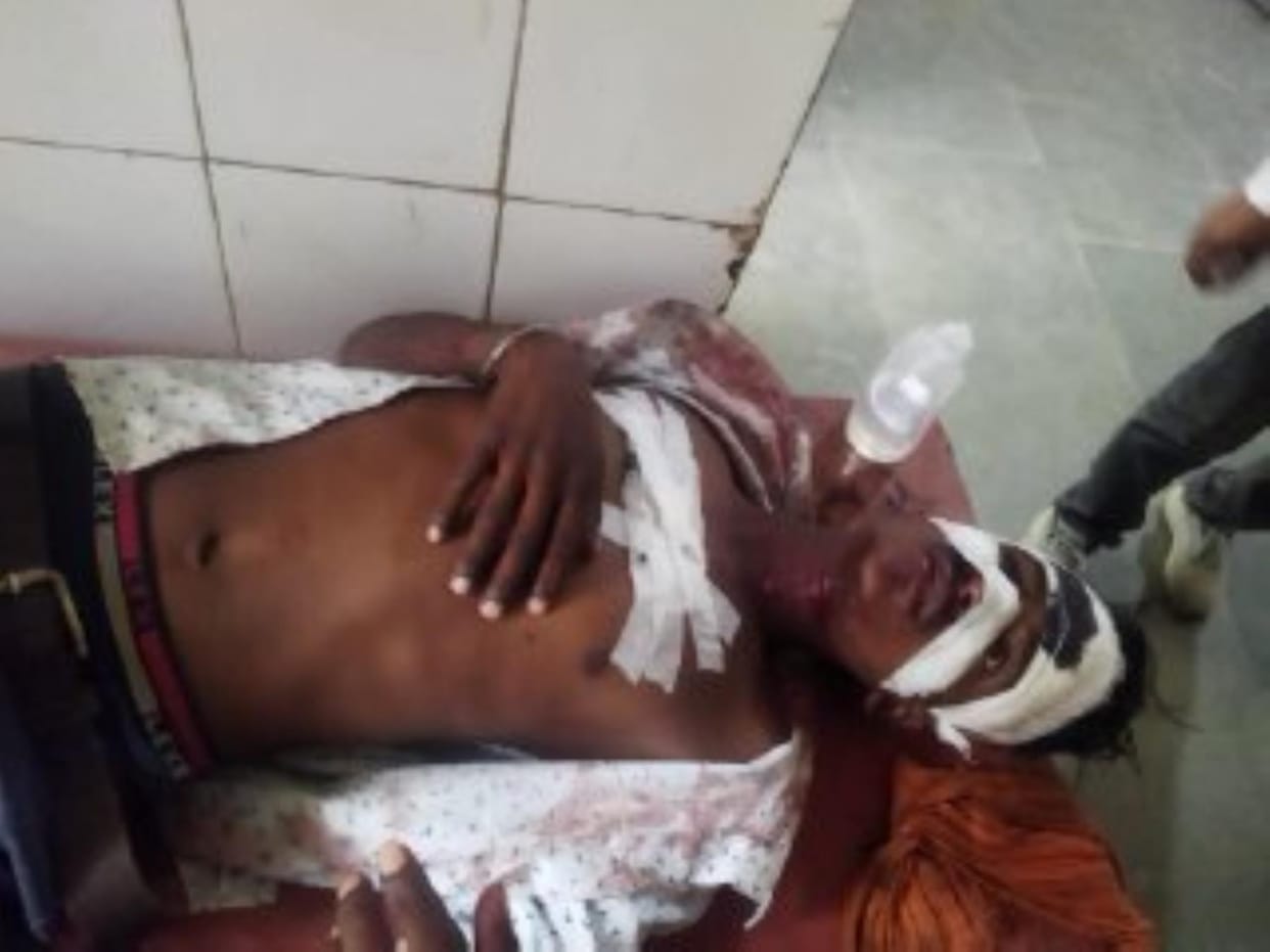 Bike rider injured after colliding with car