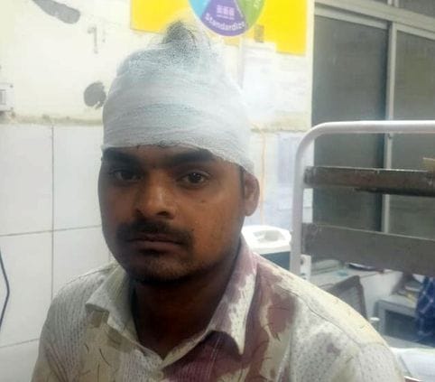 Dispute over digging a pit in front of the house, seven injured in a fight between both the parties