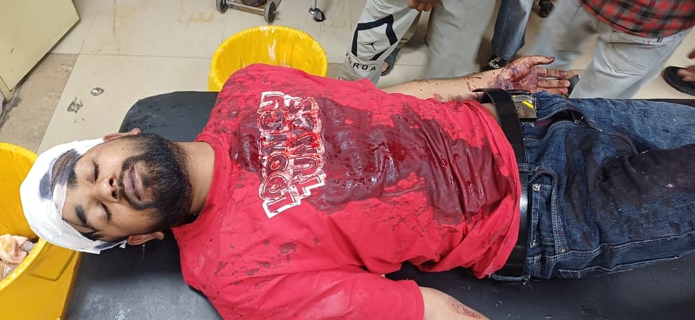 A youth was attacked with a sharp weapon, serious