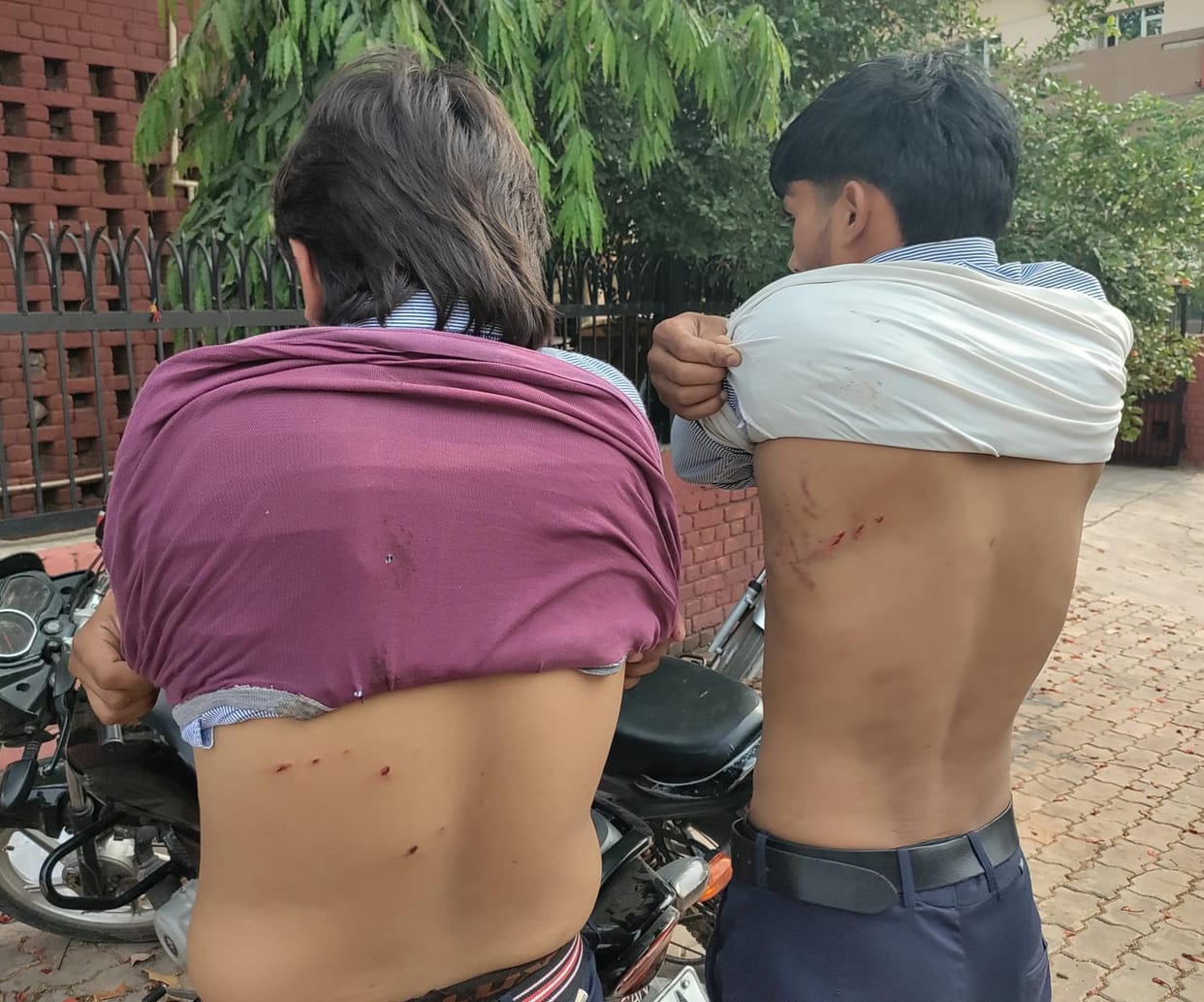 Students beaten for not removing status from Instagram, case filed against six