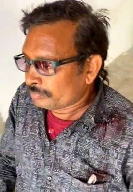 Chirala village was shaken by the sound of bullets, one injured by shrapnel