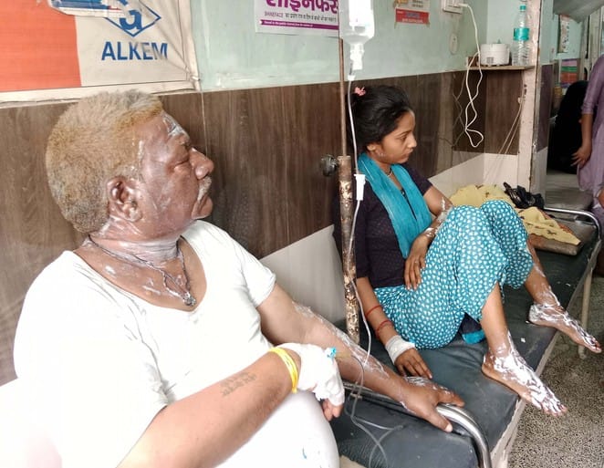 Cylinder caught fire, four burnt