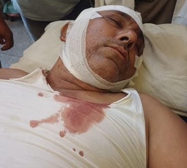 Leopard attacked and injured a farmer