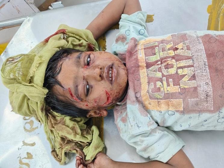 A pack of dogs attacked a girl, her condition is critical