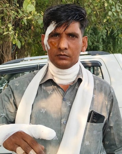 The havoc of Chinese Manjha is not stopping... it is injuring people every day