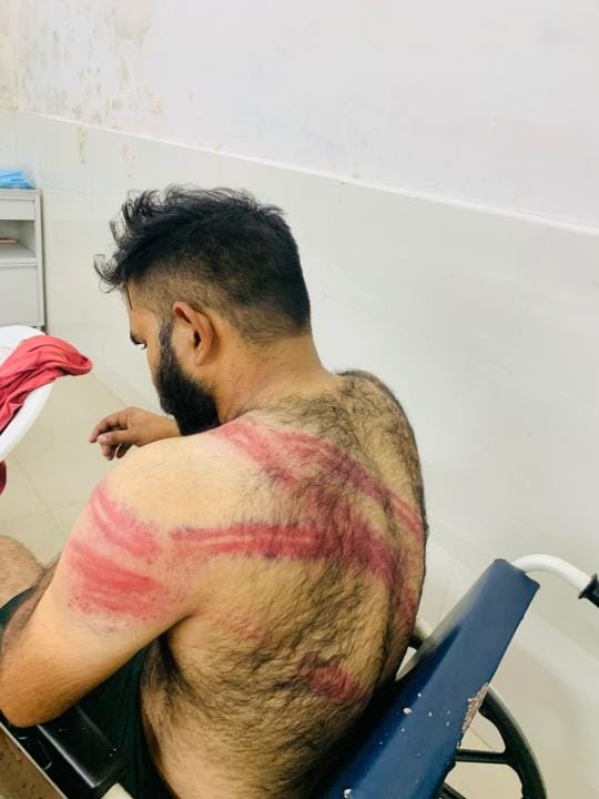 Two youths dressed as Nihangas beat up a young man in front of his in-laws' house, broke his hand