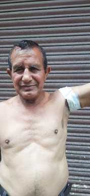 Elderly man injured in bull attack, 10 stitches on his arm