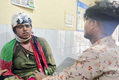 A girl got injured after being hit by the engine's belt