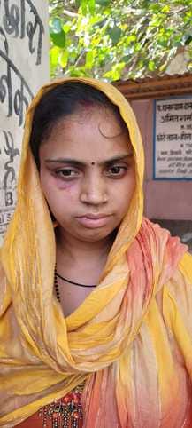 Dowry victim wandering for action