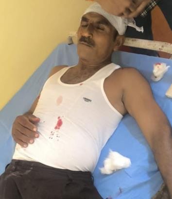 Langur mischief in Belhari, forest worker injured