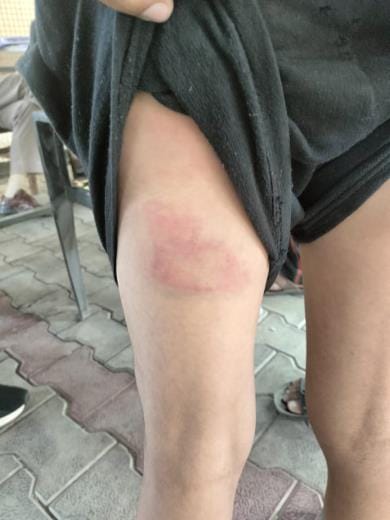 Student beaten for not completing homework