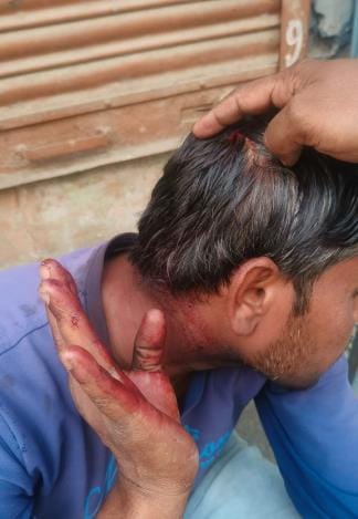 Fruit vendor attacked with weights for criticising Pakistan