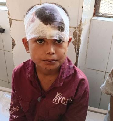 Helpless eyes were searching for loved ones groaning in pain