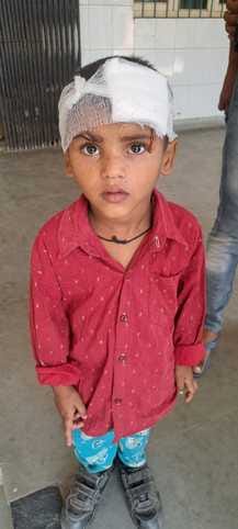Four-year-old innocent injured in pet dog attack