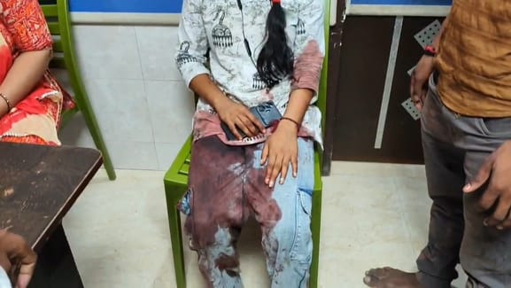 Nalanda news Police vehicle collided with a bike, 3 people including a woman were injured