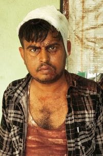 The head of a young man who tried to intervene in a fight was broken