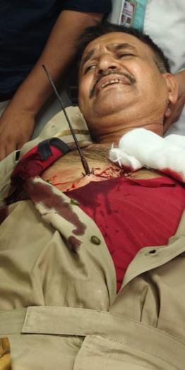 Arrow attack in CBI office, ASI injured, accused arrested