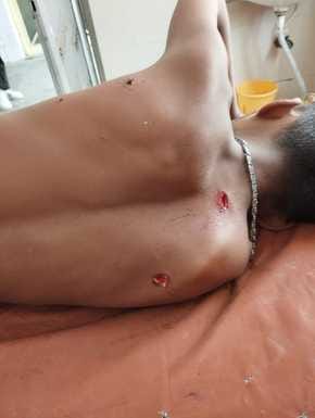 A leopard attacked a teenager who was going to give food to his grandfather in the field