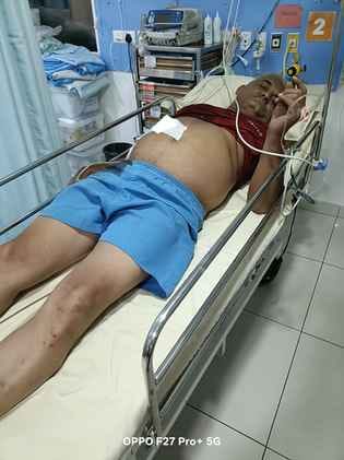 When the robbers found only 100 rupees in the pocket, they stabbed the employee in the stomach