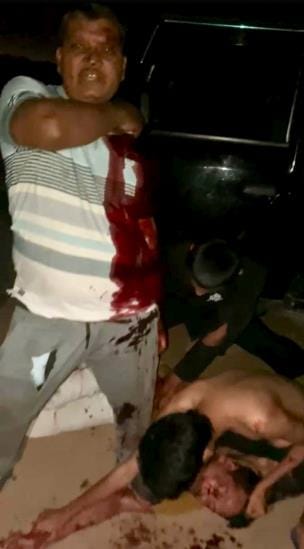 Thar driver attacks forest department guard with knife, arrested