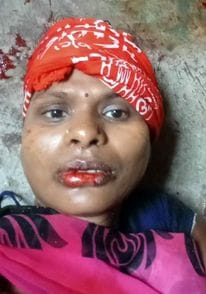 A woman was beaten to death for demanding the money she had lent