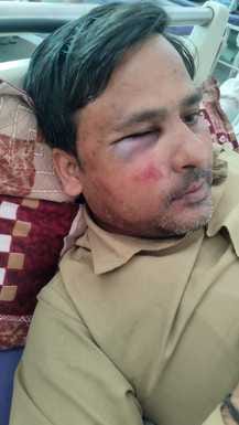 Sanitation worker beaten badly, case filed