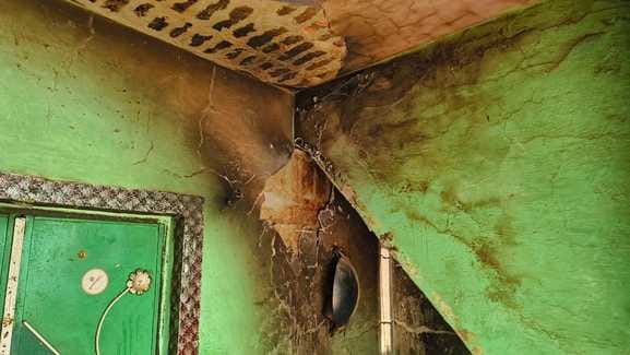 One of the four burnt in cylinder fire is in critical condition