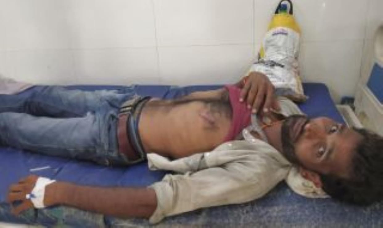 Mechanic fell from a tank under construction, serious