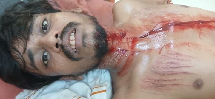 When he objected to the neighbor coming to his house, the neighbor stabbed him with a blade and left him bleeding