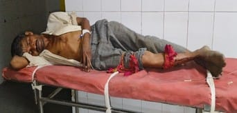 Snake bites...villager killed him and took him to hospital
