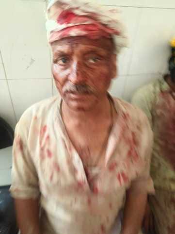 Bloody clashes over road occupation, 14 injured