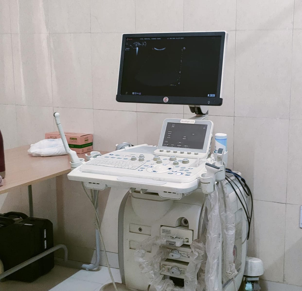 ultrasound service start in civil hospital