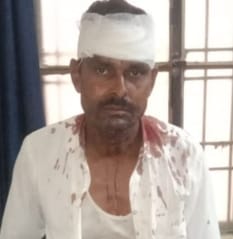 Two people, including an elderly woman, were seriously injured in monkey attack