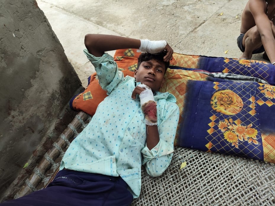 Minor attacked by crocodile