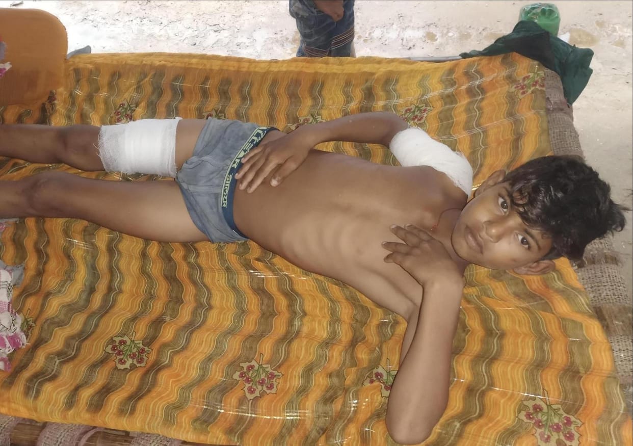 Crocodile attacks a teenager while bathing in Chambal