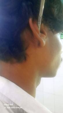 In a fight with a friend, a neighbor youth was stabbed in the head with a screwdriver