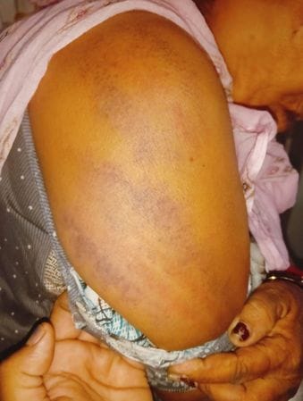 Son attacked his mother with the intention of grabbing the land, she is undergoing treatment