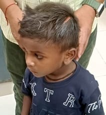 Dogs attacked and injured six people including two children